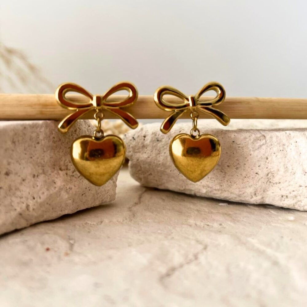 Aretes Cognus